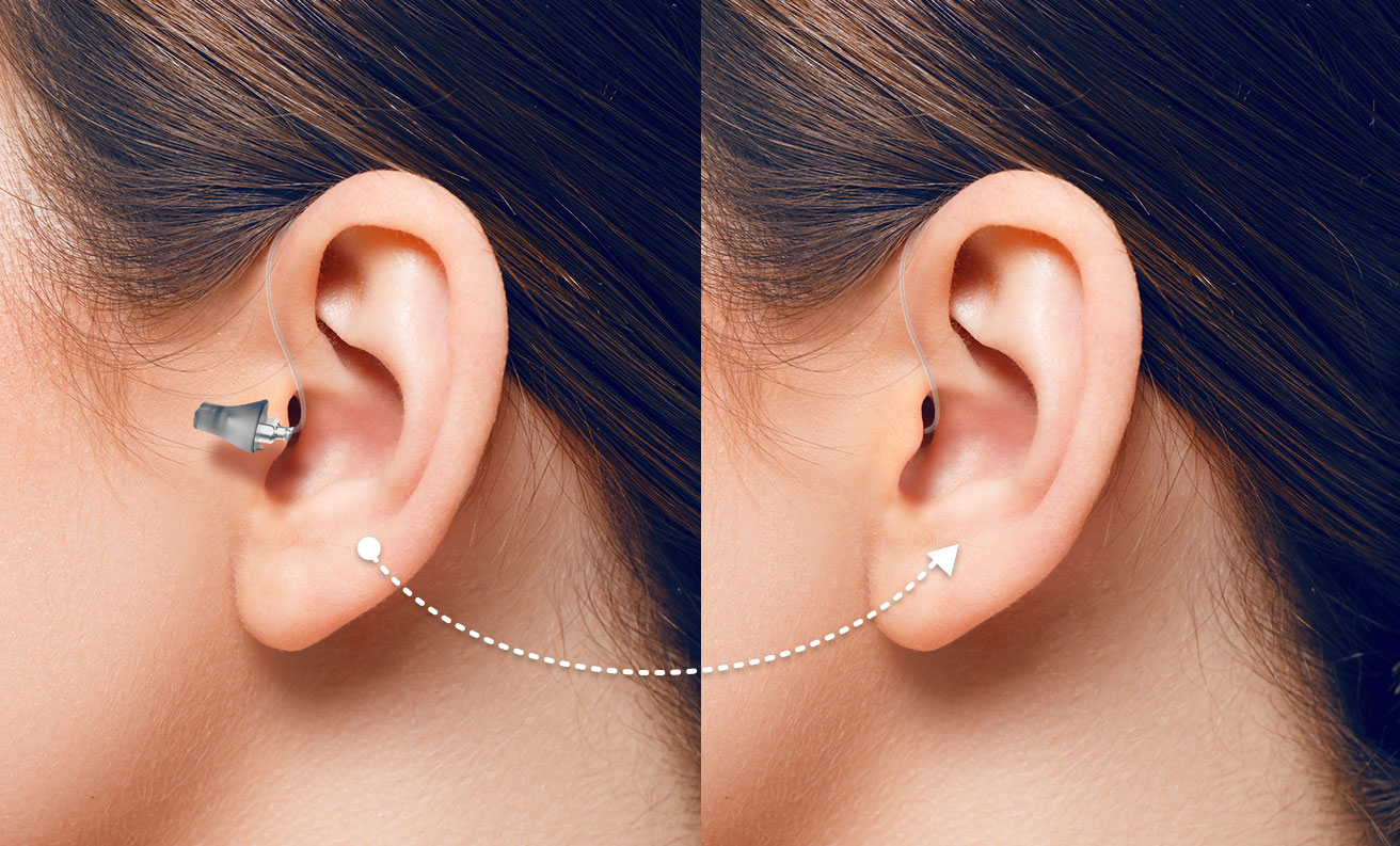 https://www.audibene.fr/wp-content/uploads/sites/14/2023/06/appareil-auditif-contour-oreille.jpeg