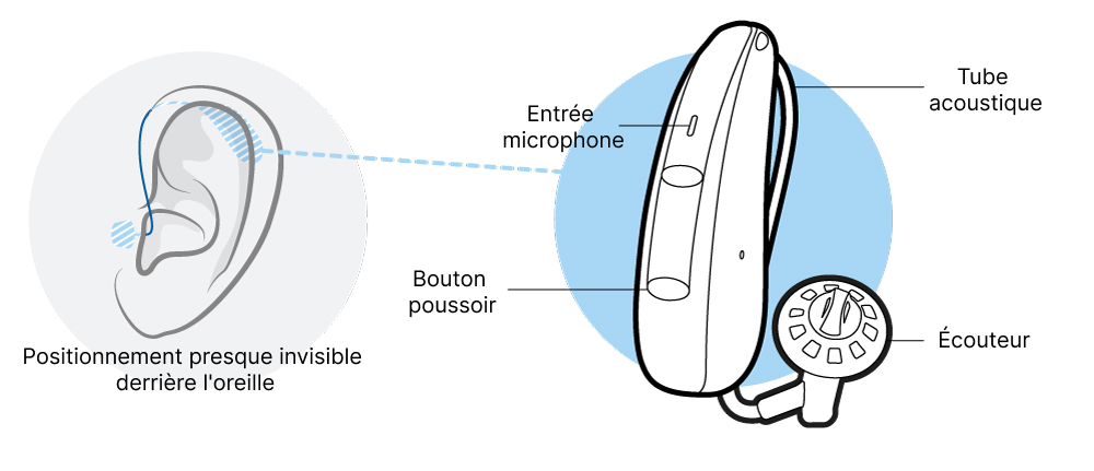 Schéma fonctionnement appareil auditif contour d'oreille